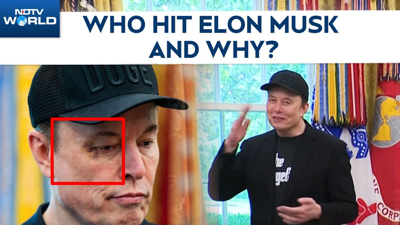 Elon Musk's Black Eye Mystery: Who Hit The Billionaire And Why?