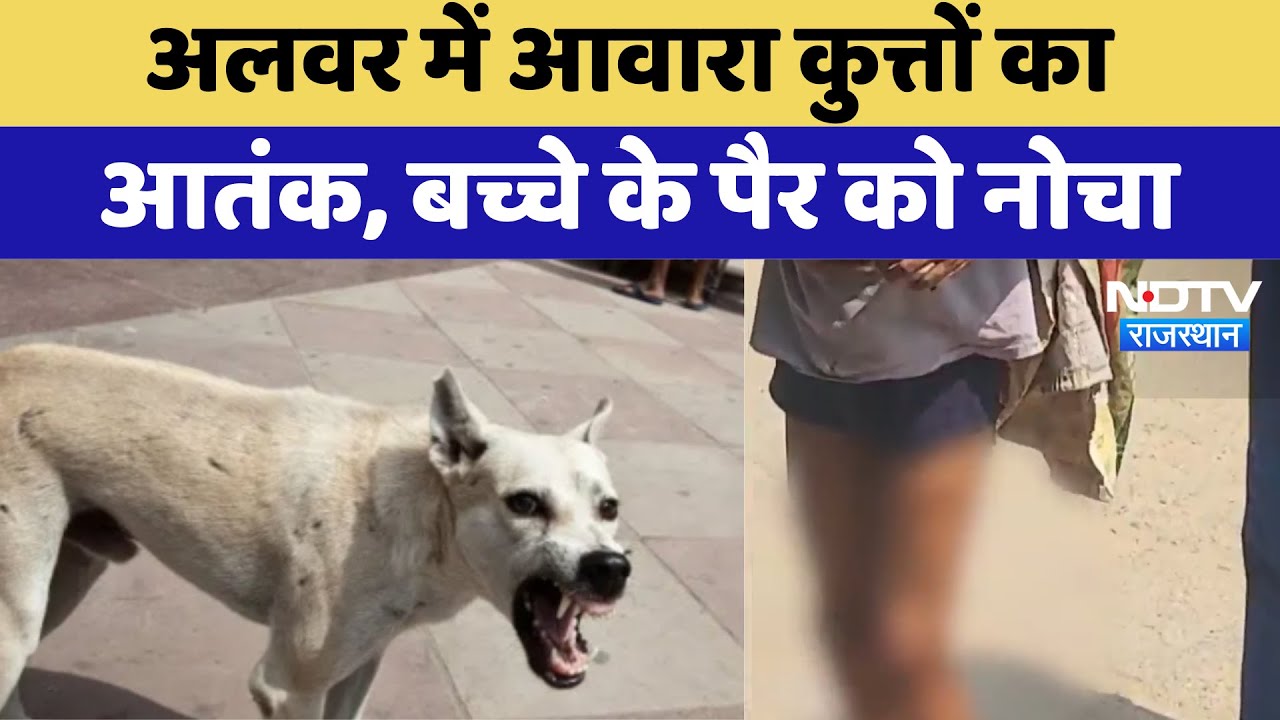 Dog Attack Alwar: अलवर में कुत्तों का कहर, बच्चे के पैर पर हमला, हालत गंभीर