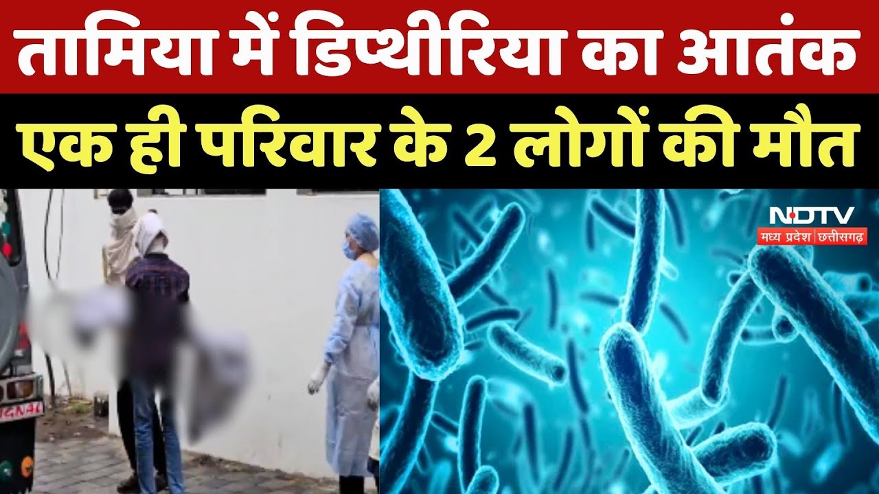 Chhindwara में Diphtheria का आतंक, एक ही परिवार के 2 लोगों की मौत