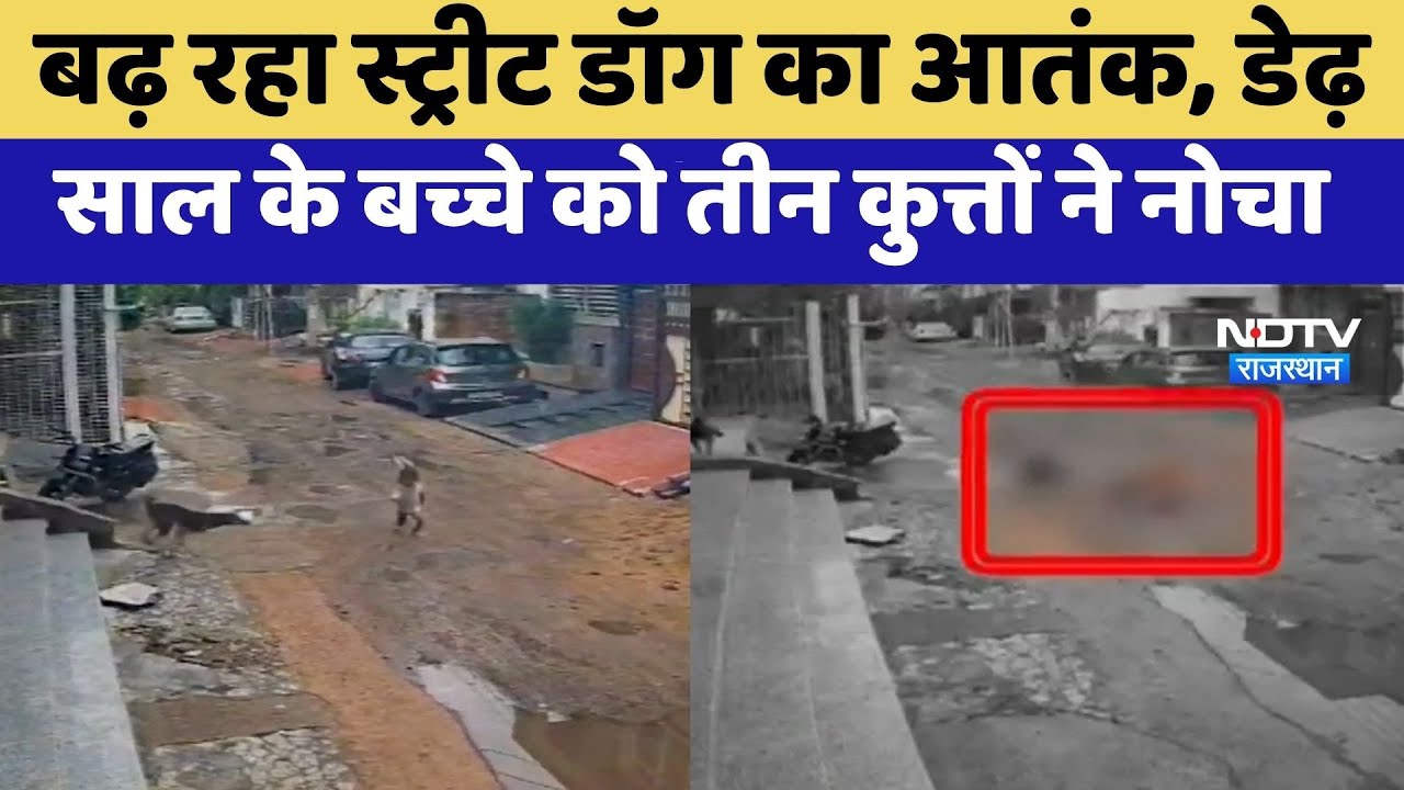 Kota News: Street Dog ने ढ़ेड़ साल के मासूम को नोचा, Video Viral | Latest News | Top News Kota News: Street Dog ने ढ़ेड़ साल के मासूम को नोचा, Video Viral | Latest News | Top News