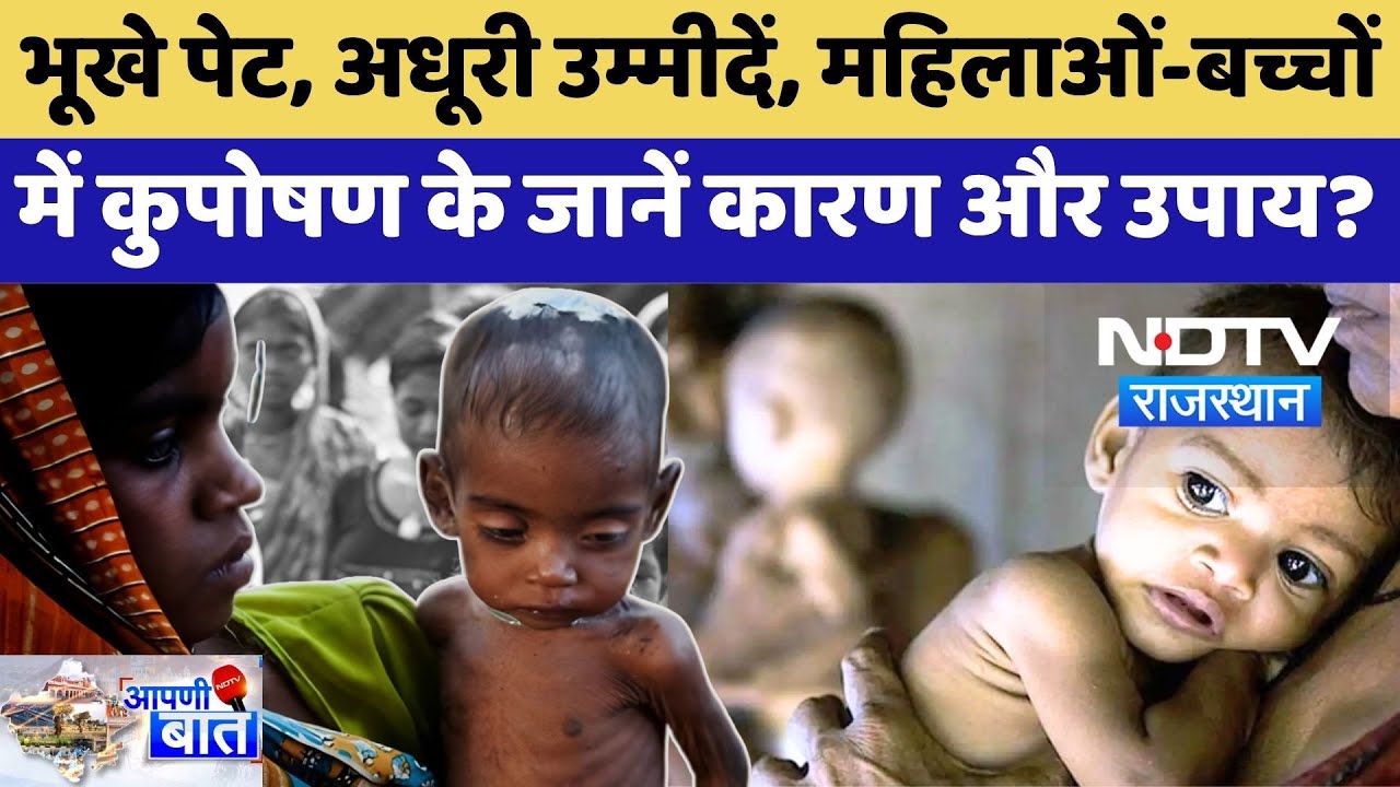 Malnutrition In Rajasthan:भूखे पेट, अधूरी उम्मीदें, महिलाओं-बच्चों में कुपोषण के जानें कारण और उपाय?