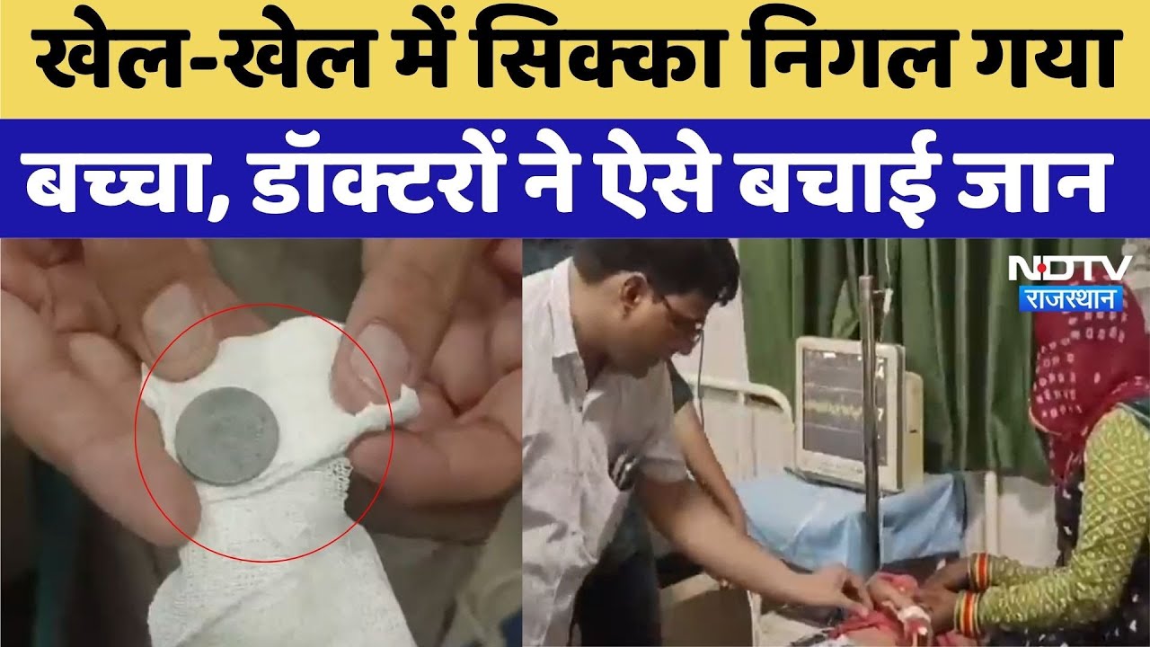 Churu News: खेलते समय बच्चे ने निगला सिक्का, Doctors ने किया सफल इलाज | Top News