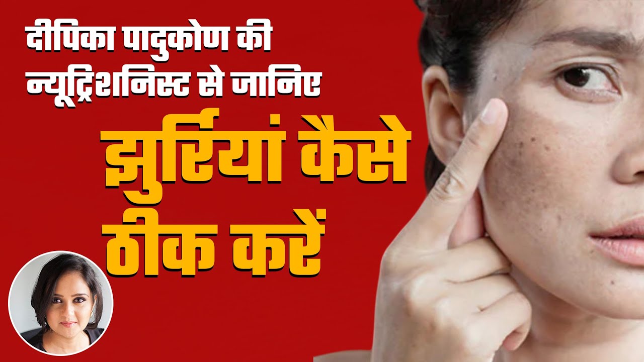 Deepike Padukone की Nutritionist ने बताया दाग-धब्बे हटाने का तरीका | Beauty Tips | NDTV India