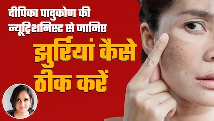 Deepike Padukone की Nutritionist ने बताया दाग-धब्बे हटाने का तरीका | Beauty Tips | NDTV India