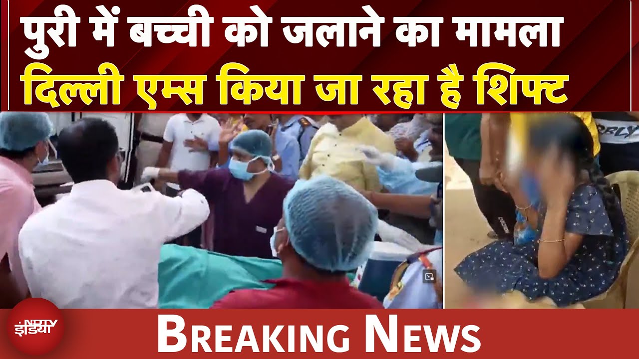 Odisha News: पुरी में बच्ची को जलाने का मामला, Delhi AIIMS किया जा रहा है शिफ्ट | BREAKING NEWS