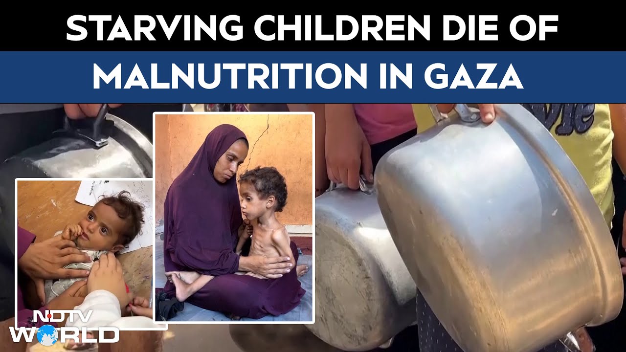 Gaza Hunger Crisis | Dozen Of Children, Adults Die Of Starvation In Gaza As Hunger Surges