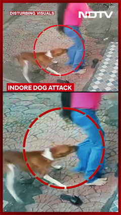 Video: Dog Attack | Girl Student Severely Injured In Stray Dog Attack In Indore