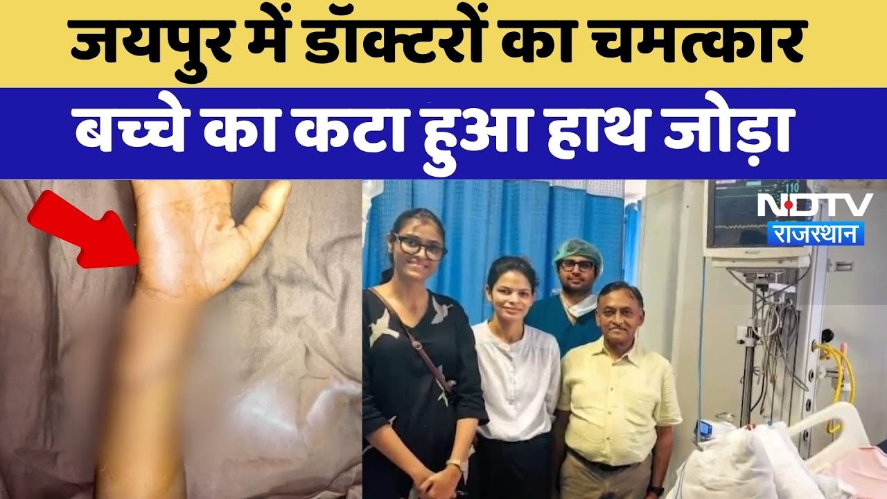 Jaipur में Doctors का चमत्कार बच्चे का कटा हुआ हाथ जोड़ा | SMS Hospital | Rajasthan News
