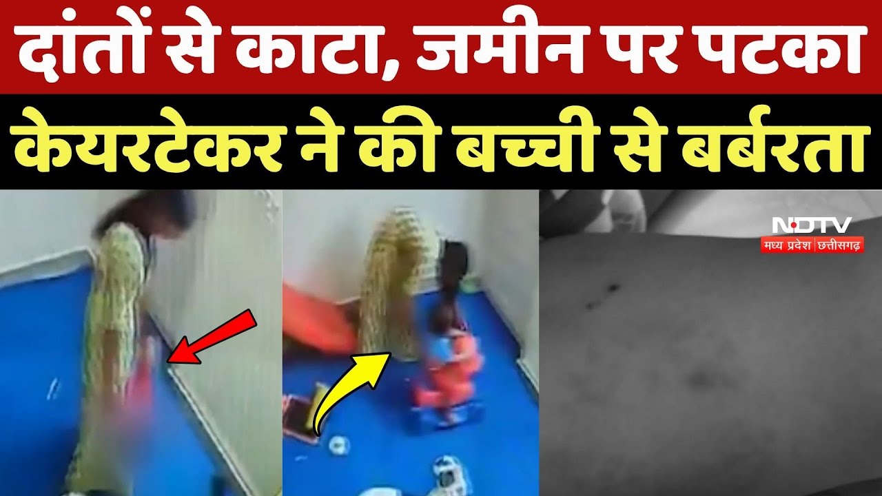 UP News: दांतों से काटा, जमीन पर पटका, Caretaker ने की बच्ची से बर्बरता