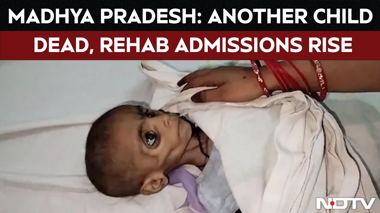 Video: Malnutrition In Madhya Pradesh: Another Child Dead, Rehab Admissions Rise