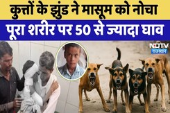 Rajasthan Dog Attack: कुत्तों के झुंड ने 8 साल के मासूम को नोचा | Alwar | Latest News | Viral Video Rajasthan Dog Attack: कुत्तों के झुंड ने 8 साल के मासूम को नोचा | Alwar | Latest News | Viral Video