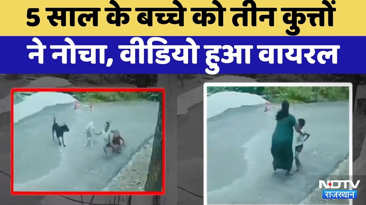 Udaipur Dog Attack News: Udaipur में 5 साल के बच्चे पर Dogs का हमला | Video Viral | Rajasthan Udaipur Dog Attack News: Udaipur में 5 साल के बच्चे पर Dogs का हमला | Video Viral | Rajasthan
