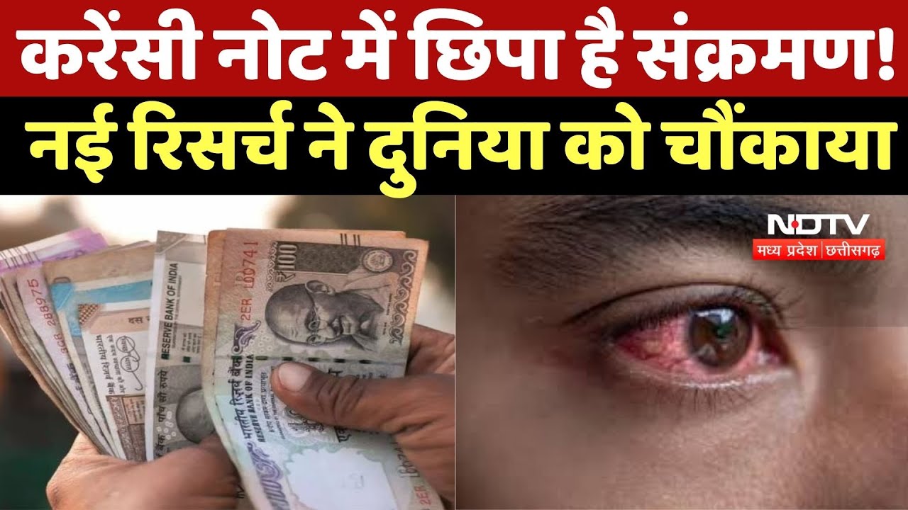 Fungus-Bacteria on Indian Currency Notes: करेंसी नोट में छिपा है संक्रमण! नई रिसर्च ने चौंकाया