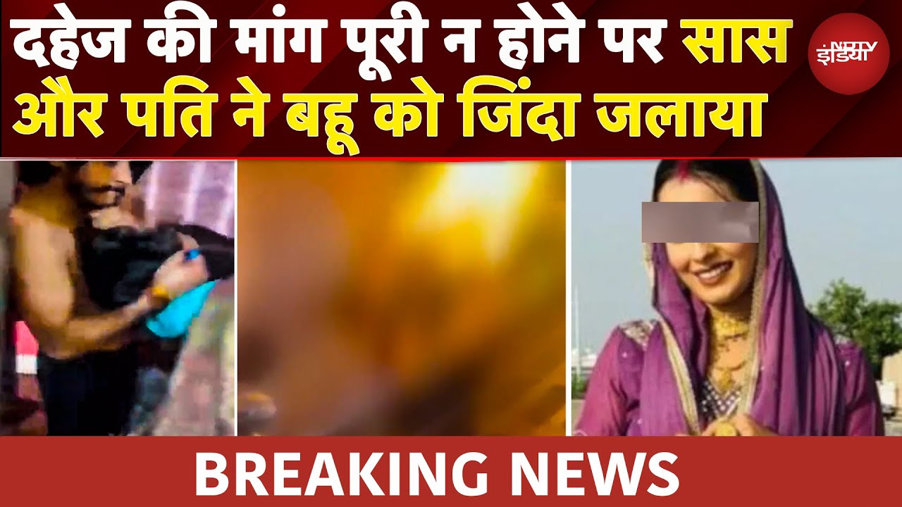Greater Noida में बहू को जिंदा जलाया, पति और सास ने मिलकर लगाई आग, जलते देख हो गए फरार | UP News