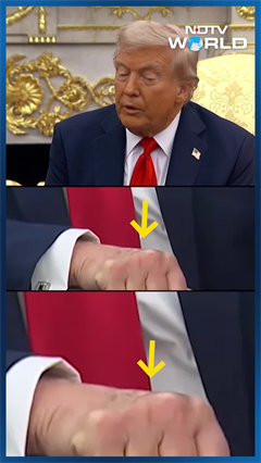 Video : Trump News | Donald Trump's Mysterious Hand Mark: Just A Bruise Or Something Bigger?