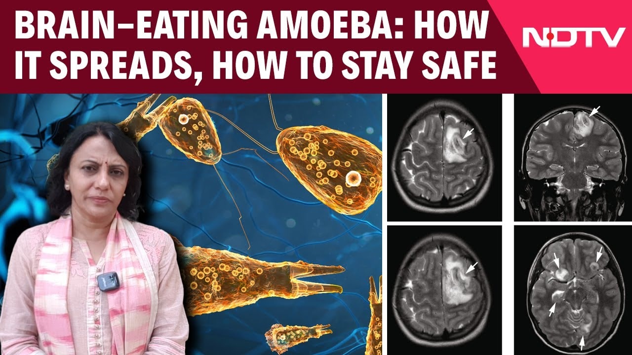 Video : Ameoba | Kerala Reports 19 Deaths from 'Brain-Eating Amoeba': How It Spreads, How to Stay Safe