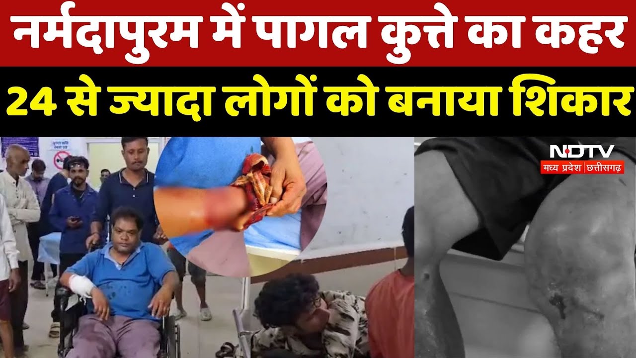 Dog Attack: Narmadapuram में पागल कुत्ते का कहर, 24 से ज्यादा लोगों को बनाया शिकार, कई की हालत गंभीर