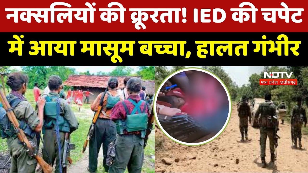 Naxalites Blast IED: नक्सलियों की बिछाई IED की चपेट में आया बच्चा, ब्लास्ट होते ही बुरी तरह घायल