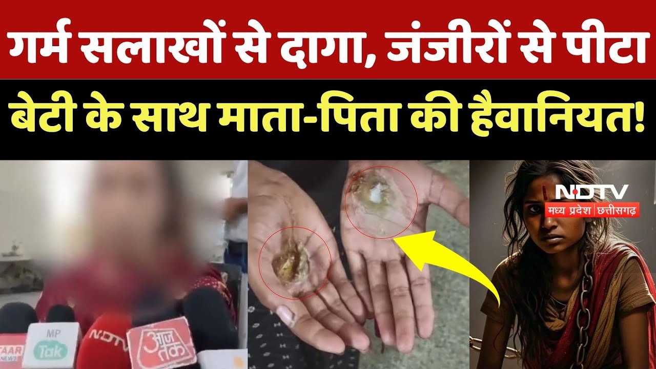 Ujjain Crime News: जंजीर से पीटा, जलाईं हथेलियां, बेटी के साथ माता पिता ने क्यों की बेरहमी?