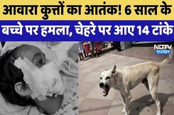 Alwar Dog Attack: आवारा कुत्तों का आतंक, बच्चे पर हमला, चेहरे पर आए 14 टांके | Top News Alwar Dog Attack: आवारा कुत्तों का आतंक, बच्चे पर हमला, चेहरे पर आए 14 टांके | Top News