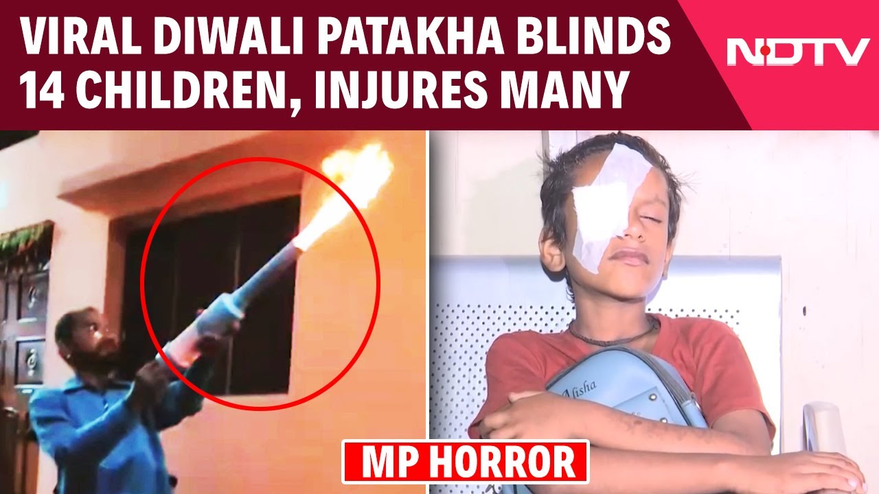 Video: 14 Children Lose Eyesight In MP Playing With 'Carbide Gun' Cracker On Diwali