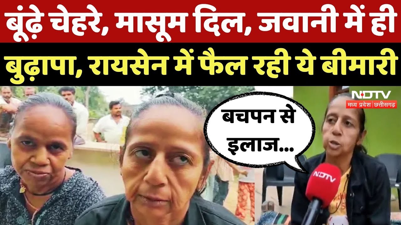Rarest Disease Patients: जवानी में ही बुढ़ापा, ये कैसी बीमारी?| Hutchinson-Gilford Progeria Syndrome Rarest Disease Patients: जवानी में ही बुढ़ापा, ये कैसी बीमारी?| Hutchinson-Gilford Progeria Syndrome