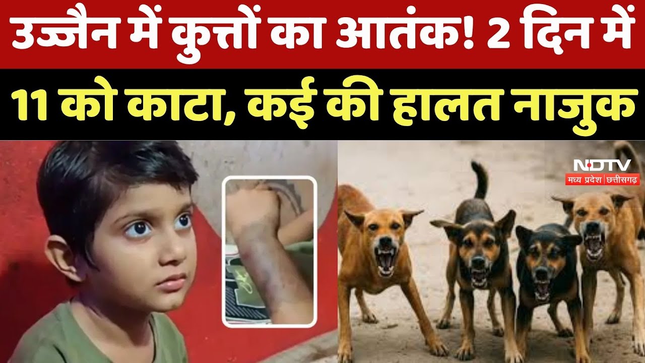 Dog Bite : 2 दिन में 11 लोगों को काटा, मासूम के हाथ में फंसा दांत, उज्जैन में आवारा Dogs का आतंक