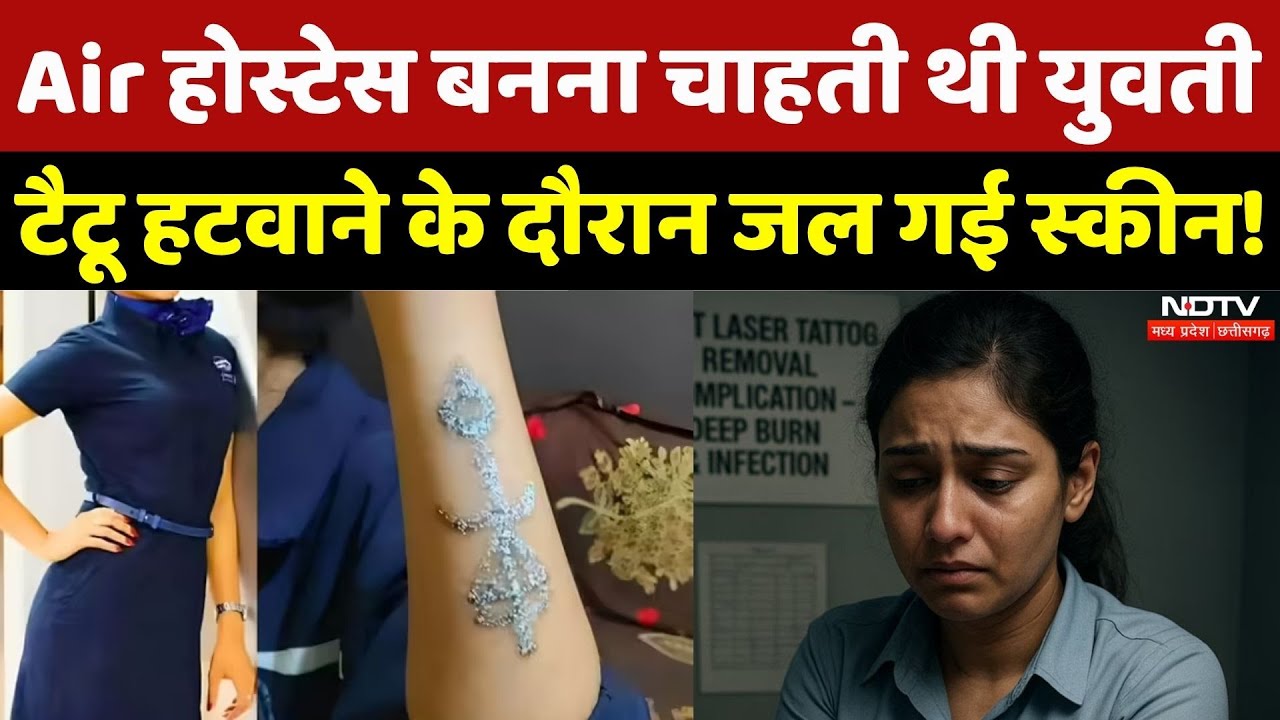 Indore News: Tattoo बना दुश्मन, Air होस्टेस बनने का सपना टूटा! | Madhya Pradesh | Tattoo Treatment