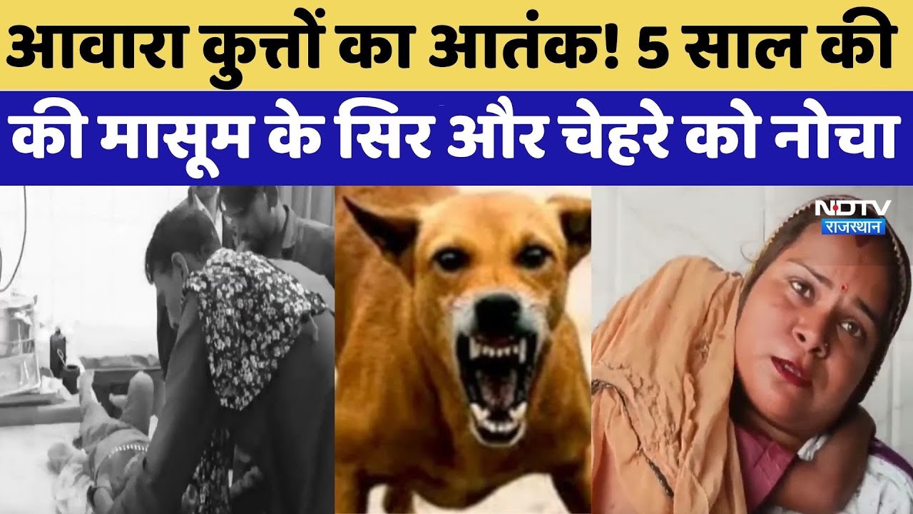 Kota Dog Attack: आवारा कुत्तों का आतंक! 5 साल की मासूम के सिर और चेहरे को नोचा | Latest News