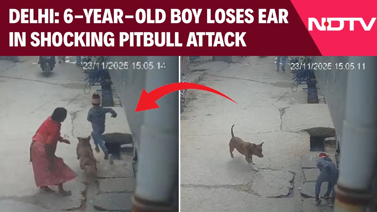 Delhi News | Delhi Horror: 6-Year-Old’s Ear Bitten Off By Pitbull, Dog Owner Arrested