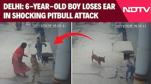Delhi News | Delhi Horror: 6-Year-Old’s Ear Bitten Off By Pitbull, Dog Owner Arrested