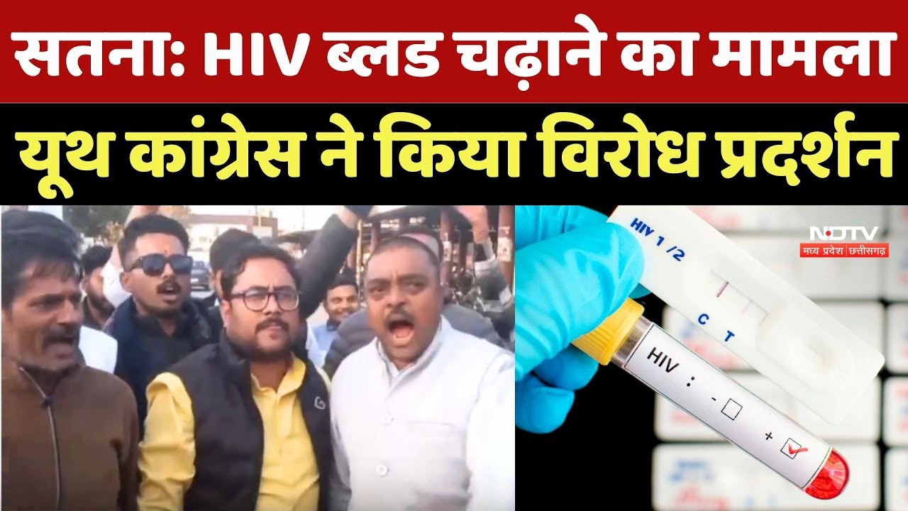 Satna Protest: HIV Blood चढ़ाने का मामला, Youth Congress ने किया विरोध प्रदर्शन