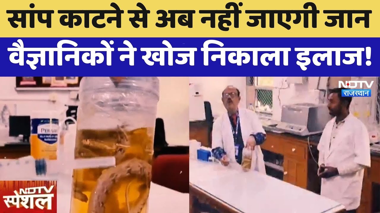 Bikaner: Snake Bite से अब नहीं जाएगी जान, वैज्ञानिकों ने खोज निकाला इलाज! | Camel Blood
