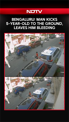 Bengaluru: Man Kicks 5-Year-Old Child to the Ground, Leaves Him Bleeding