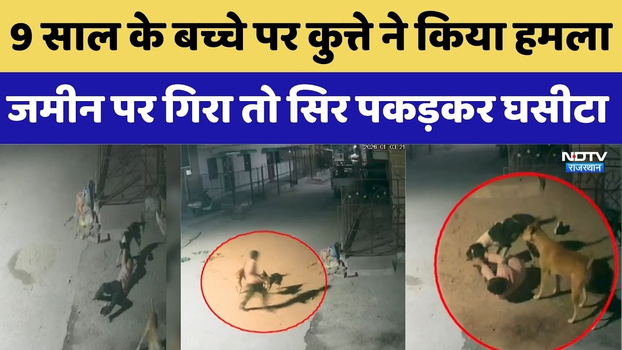 Jodhpur News: 9 साल के बच्चे पर कुत्ते ने किया हमला, गिरा तो सिर पकड़कर घसीटा। Top News । CCTV