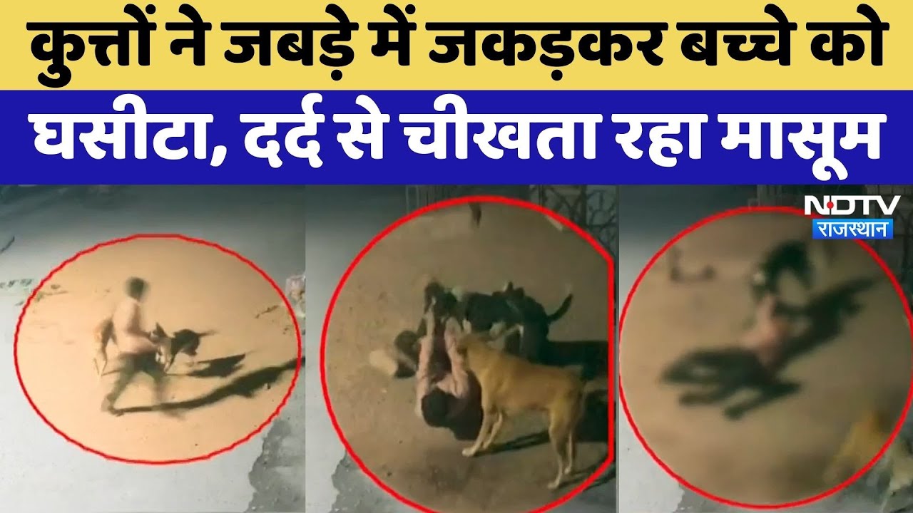 Jodhpur News: 9 साल के बच्चे पर कुत्ते ने किया हमला | Video Viral | Rajasthan Top News | Top News