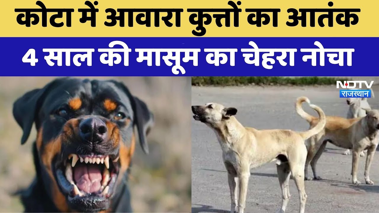 Stray Dog Attack:  Kota में आवारा कुत्तों का आतंक, 4 साल की मासूम का चेहरा नोचा