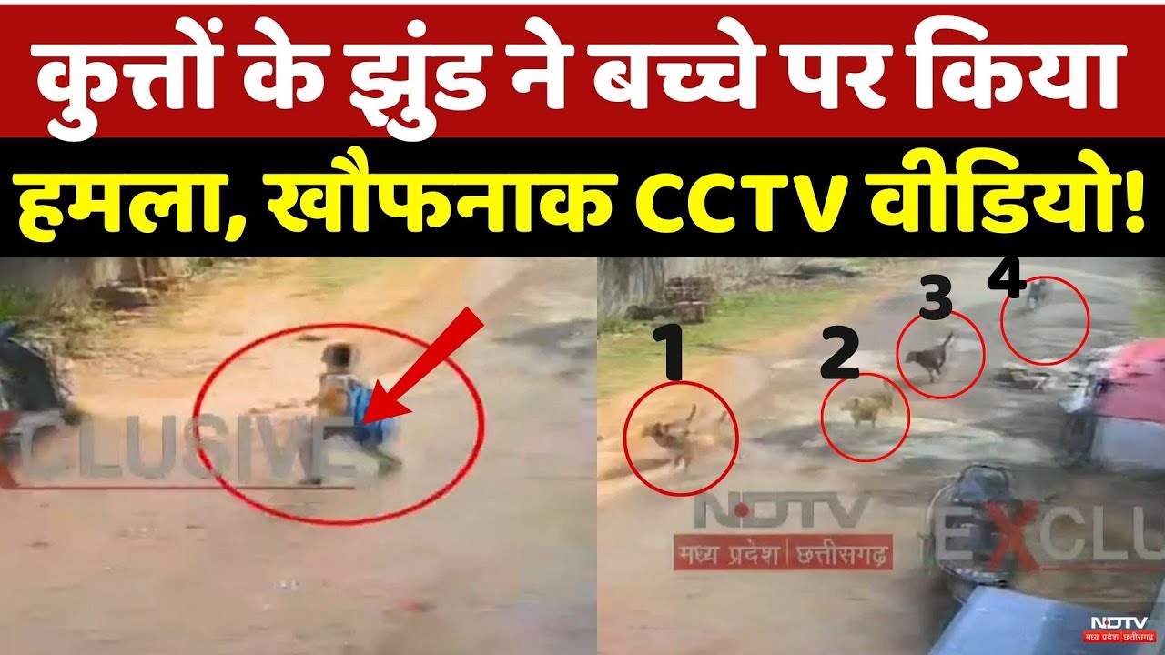 Dog Attack on Child: कुत्तों के झुंड ने बच्चे पर किया हमला, डरा देगा वीडियो! | Viral | MP | Top News