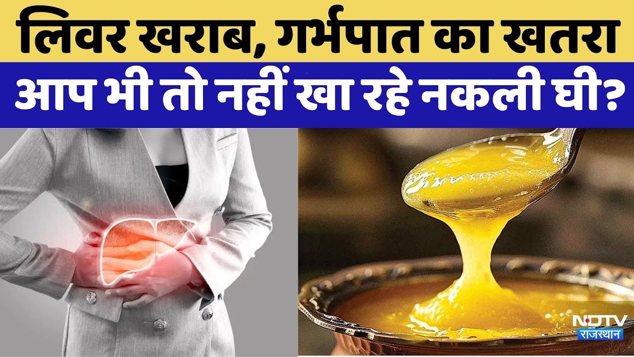Fake Ghee खाने से हो रही ये बीमारियां | Rajasthan Top News | Punjab | Haryana | Latest News