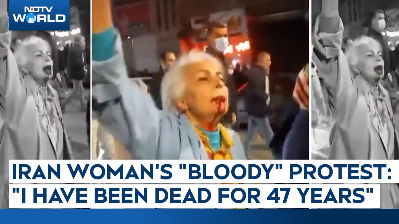 Iran Woman's "Bloody" Protest: "I Have Been Dead For 47 Years"
