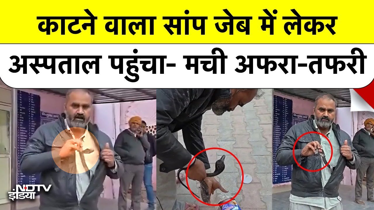 Snake Bite in Mathura: सांप ने काटा तो पकड़कर जैकेट में रखा और पहुंच गया डॉक्टर के पास!