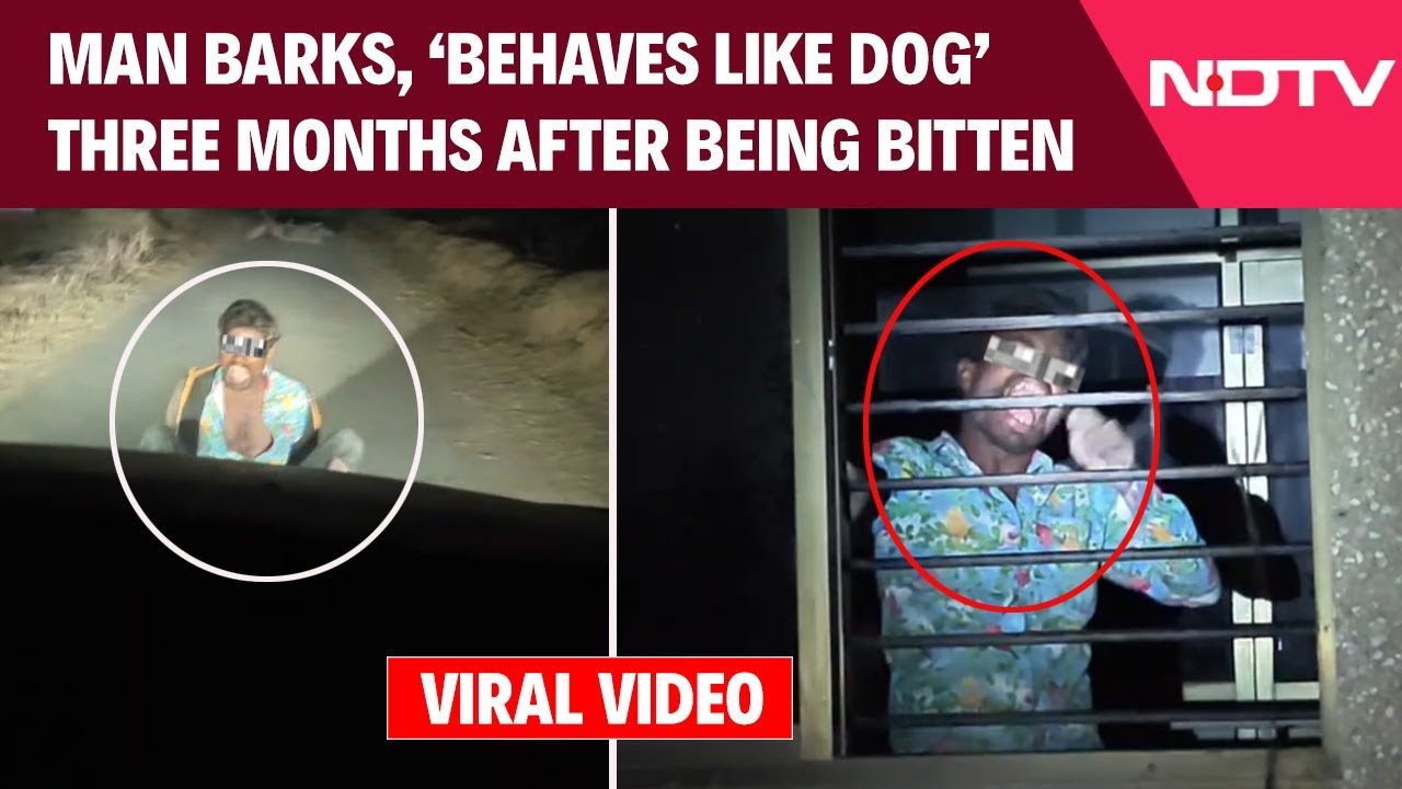 Suspected Rabies Case In Gujarat: Man Hospitalised After Disturbing Behaviour