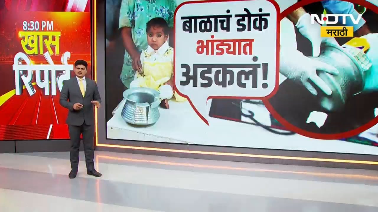 खेळता खेळता डोकं भांड्यात अडकलं, पाहा डॉक्टर आणि प्लंबरनं काय केलं? | Special Report