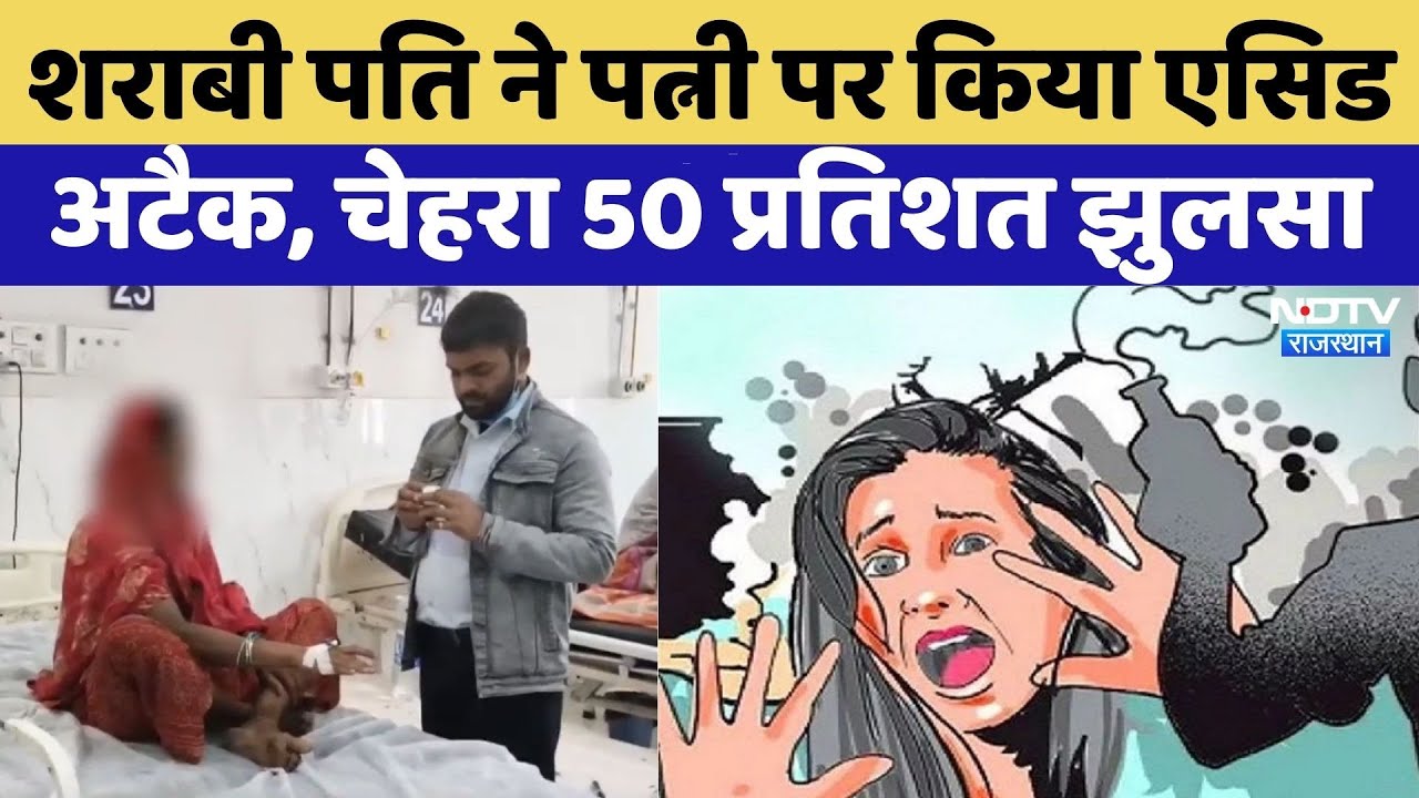 Rajasthan में दिल दहला देने वाला Acid Attack, पत्नी का चेहरा 50 प्रतिशत झुलसा | Rajasthan Top News