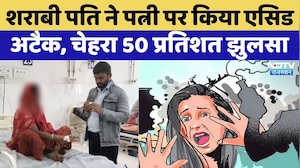 Rajasthan में दिल दहला देने वाला Acid Attack, पत्नी का चेहरा 50 प्रतिशत झुलसा | Rajasthan Top News