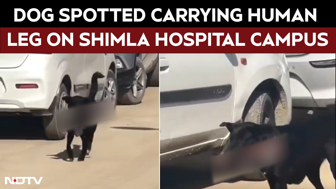 Shimla News | Dog Spotted Carrying Human Leg On Shimla Hospital Campus