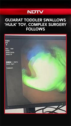 Gujarat Toddler Swallows 'Hulk', A Complicated Procedure Follows