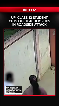 Class 12 Student Cuts Off Teacher's Lips In Roadside Attack In UP