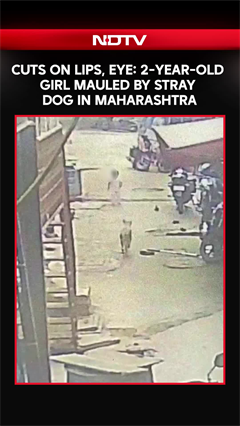 Cuts On Lips, Eye: 2-Year-Old Girl Mauled By Stray Dog In Maharashtra