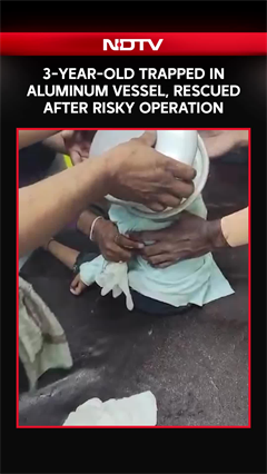 Jalgaon: 3-Year-Old Trapped In Aluminum Vessel, Rescued After Risky Operation